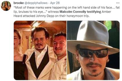 Los usuarios de Twitter revelaron una nueva imagen del actor con un pómulo hinchado