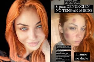 La escalofriante denuncia de Lourdes, de Bandana, contra su expareja y la medida que tomó la Justicia