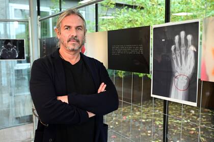 Luca Lo Presti, fundadora de la asociación Pangea Onlus, posa junto a una imagen de una radiografía de la muñeca rota de una mujer