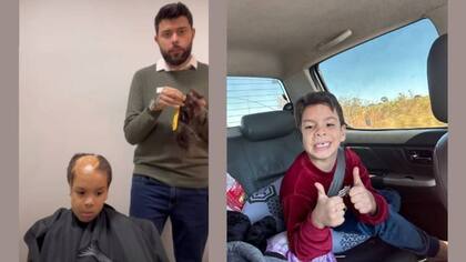 Lucas antes y después de recibir la prótesis capilar.