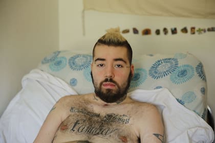 Lucas Cabello, con las secuelas del ataque que casi lo mata