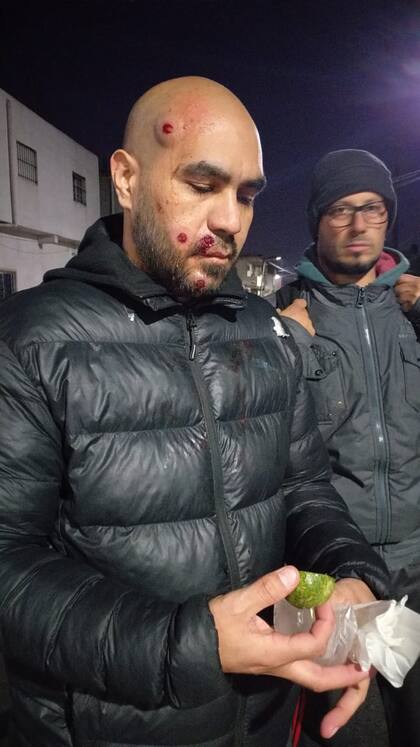 Lucas Santillán, docente agredido.