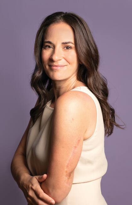 Lucía Villarreal (39) atravesó un vidrio y se hizo un corte profundo en el brazo.