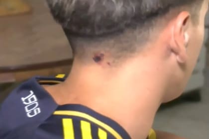 Luciano, el joven que fue herido por su novia, camino al colegio en San Martín