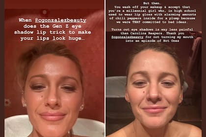 Luego de la gala Lively detalló el truco de los labios carnosos en sus redes. (Instagram blakelively)