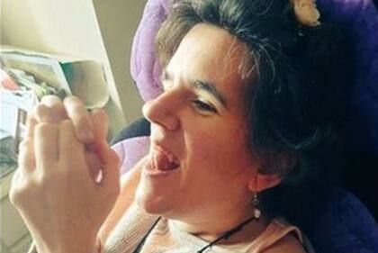 Luego están sus manos, que por el síndrome de Rett se retuercen diariamente desde la infancia.