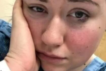 Lyndsi Johnson tuvo un cambio en su vida luego de que sus síntomas aparecieron en 2015