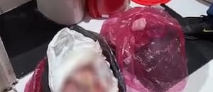 El caso de la niña de 12 años abusada y el hallazgo de ocho fetos en una clínica de Villa Ballester