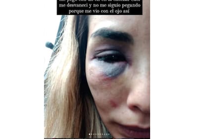 Macarena hizo público el calvario que vivió con quien era su pareja