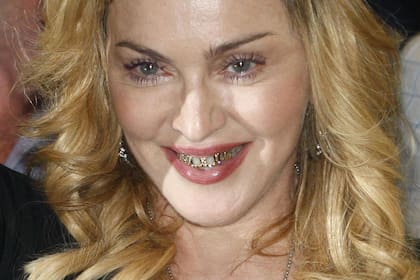 Madonna, con joyas en los dientes