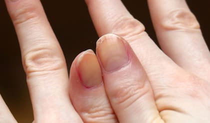 Manchas blancas en las uñas: ¿qué son y por qué salen?