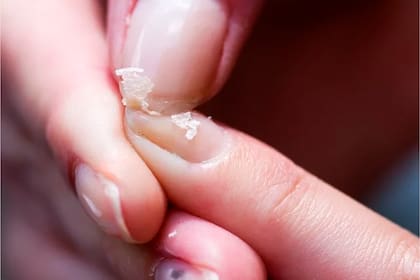 Manchas blancas en las uñas: ¿qué son y por qué salen?