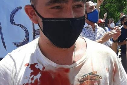 Uno de los manifestantes heridos