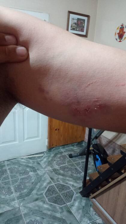 Marcas en el cuerpo de Cristian Fernández