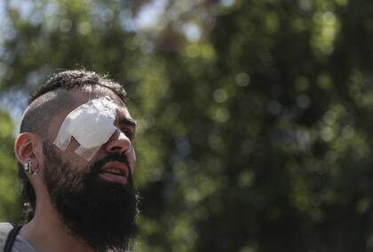 Marcelo Herrera, con los ojos vendados por una lesión que recibió durante las protestas recientes, participa en una manifestación en apoyo de los que resultaron heridos en el ojo por la policía chilena
