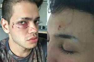 Ataque homofóbico en Palermo: dos jóvenes fueron agredidos brutalmente