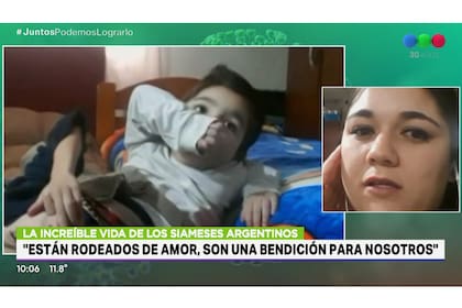 María Belén Romero, la madre de los gemelos Agustín y Gael: nacieron unidos y su separación implica muchos riesgos