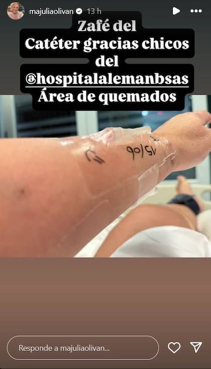 María Julia Oliván contó cómo evoluciona su salud tras sufrir graves quemaduras.
