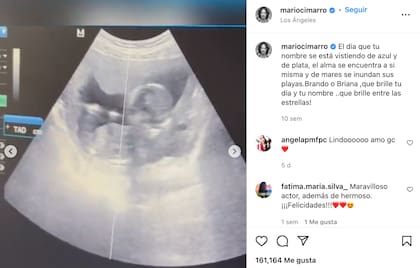Mario Cimarro comparte la ecografía de su primer bebé