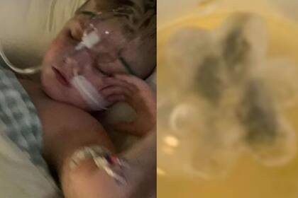 Marley fue ingresado en la Unidad de Cuidados Intensivos (UCI) del Royal Children’s Hospital de Melbourne.