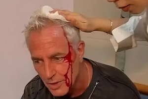 Marley tuvo una accidentada experiencia en China y mostró cómo quedó