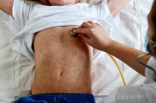 Coronavirus: advierten que crece el riesgo de sarampión para millones de chicos