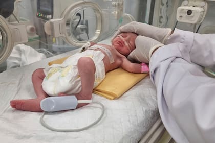 Más de 300 niños han nacido en Europa en partos en los que se utilizó el OdonAssist, sin presentar ningún tipo de lesión