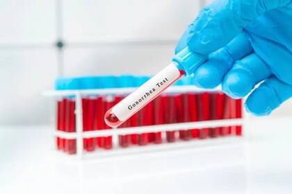 Más diagnósticos equivalen a más casos, según el ECDC, aunque esto no explicaría por sí solo el aumento de infecciones