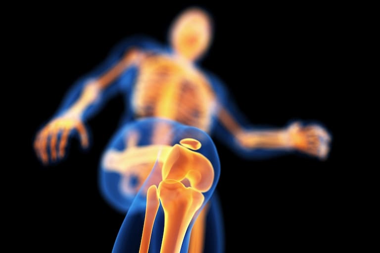 revertir la osteoporosis.