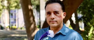 El impresionante relato del mexicano que sobrevivió a la mordida de un tiburón en la cabeza