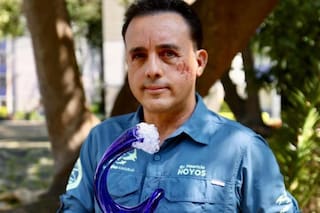 El impresionante relato del mexicano que sobrevivió a la mordida de un tiburón en la cabeza