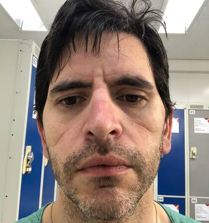 Mauro Tamagno es rosarino y ya operó a más de 20 pacientes con Covid-19