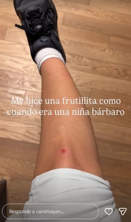 Mayan mostró la herida que le quedó en la rodilla (Foto: Instagram @camimayan)