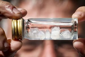 ¿Cuál es la picadura más dolorosa del mundo?