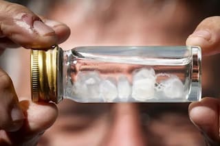 ¿Cuál es la picadura más dolorosa del mundo?