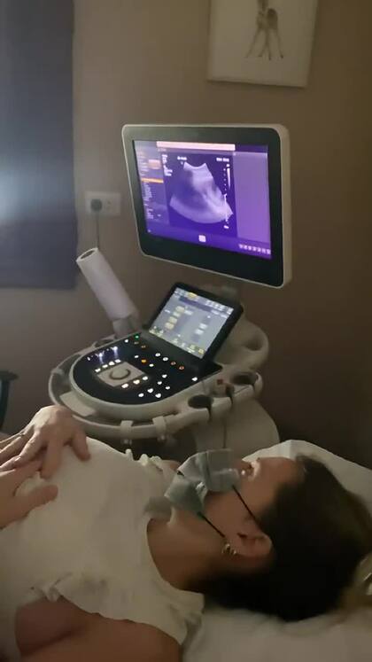 Mica Viciconte compartió su primer ecografía