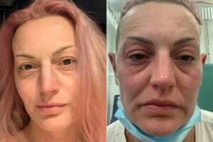 Michelle Flower, la mujer oriunda del Reino Unido que "envejeció" luego de aplicarse la dosis de refuerzo por el Covid-19