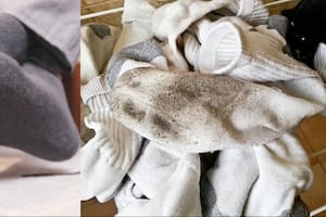 Microbiólogos explican los problemas de salud por usar las mismas medias varias veces