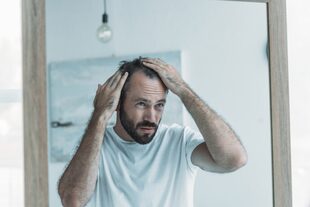 Los primeros signos de la caída tienen que ver con un afinamiento del pelo, el que comienza a perder diámetro y grosor, le cuesta crecer o lo hace de manera delgada hasta que se frena