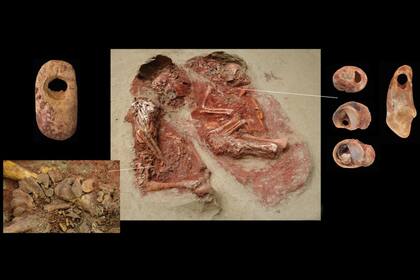 Mientras que un bebé sobrevivió al nacimiento a las 6-7 semanas, el otro aparentemente murió al nacer o poco después