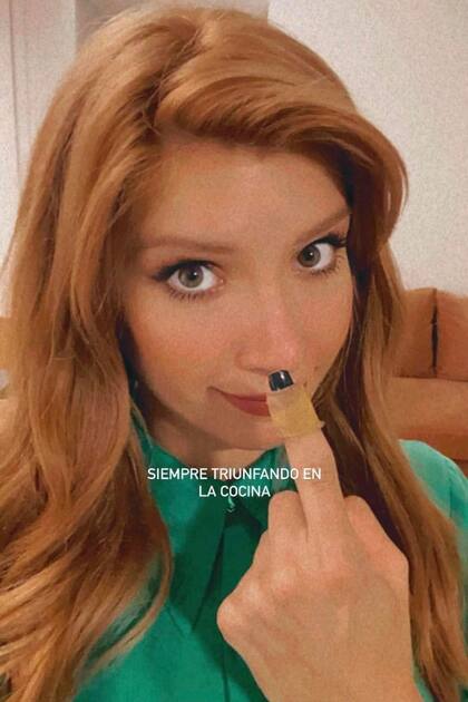 Mientras se prepara para conducir El club de las divorciadas, Laurita Fernández mostró un desliz que sufrió en la cocina