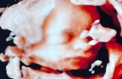 Milenka nacerá en Estados Unidos, al igual que su hermano Mirko