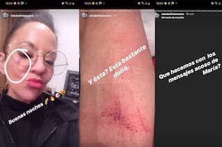 Miss Bolivia y las fotos sobre la violencia de género que sufrió