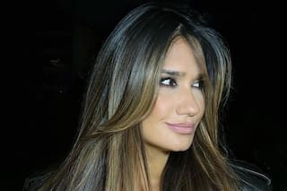 Momi Giardina se sometió a una cirugía estética y contó el motivo detrás de su decisión