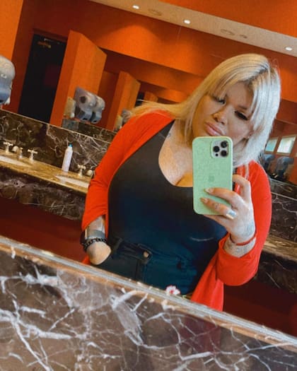 Morena Rial se sometió a varias cirugías estéticas y contó todos los detalles en las redes sociales