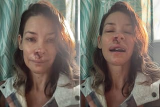 Evangeline Lilly contó detalles del accidente que sufrió en la playa: "Fue un reinicio"