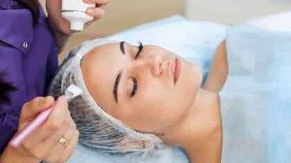 Muchas pacientes con acné gastan mucho dinero en productos de belleza buscando la crema perfecta