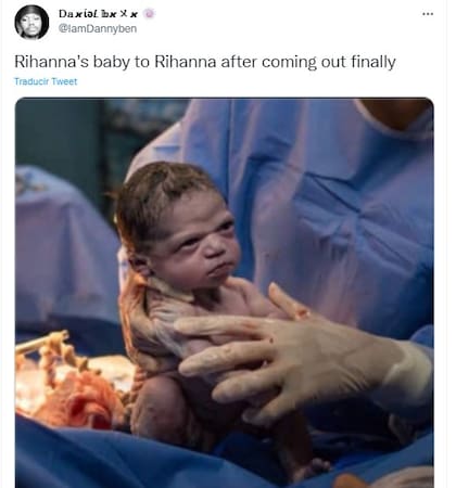 Muchos compararon al recién nacido con la niña Isabela