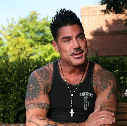 Ricardo Fort, un ejemplo del efecto que logran los implantes