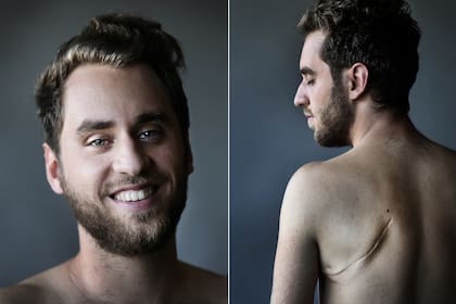 Nació, el 9 de mayo de 1995: prematuro, diminuto, tras 25 semanas de gestación, midiendo 30 centímetros y pesando 770 gramos. Foto: Fernando Gutierrez